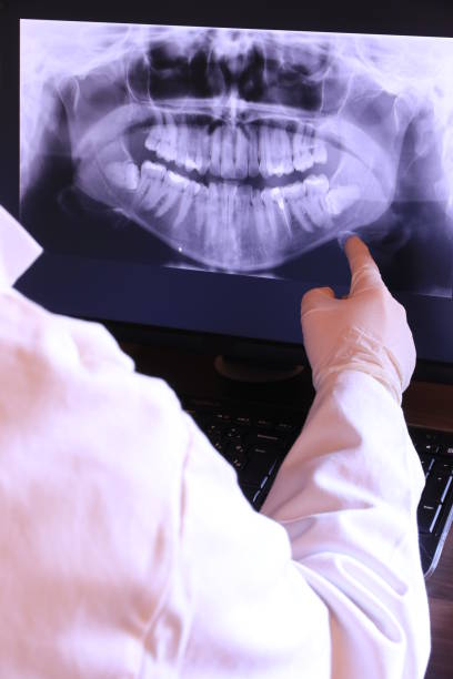 Best Cracked Tooth Emergency Dentist  in Honeygo, MD