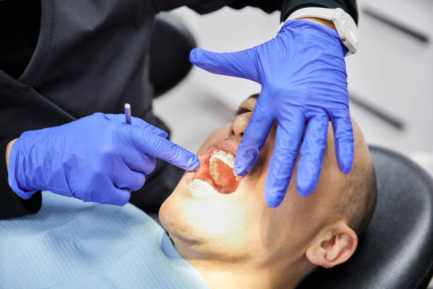 Best Emergency Tooth Extraction  in Honeygo, MD