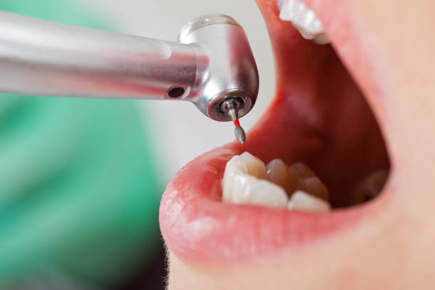 Best Knocked-Out Tooth Emergency  in Honeygo, MD